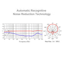 CKMOVA Large Diaphragm Studio Cardioid Condenser Microphone - SXM5